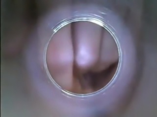 Vaginal uterus and intravaginal ejaculation307